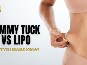 Tummy Tuck Versus Liposuction: What You Should Know